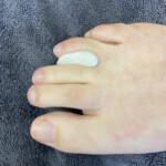 Zwischenzehenorthese