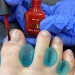 Lackieren der Nägel