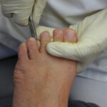 Schneiden der Nägel